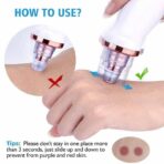 Black Head Remover - Image 6